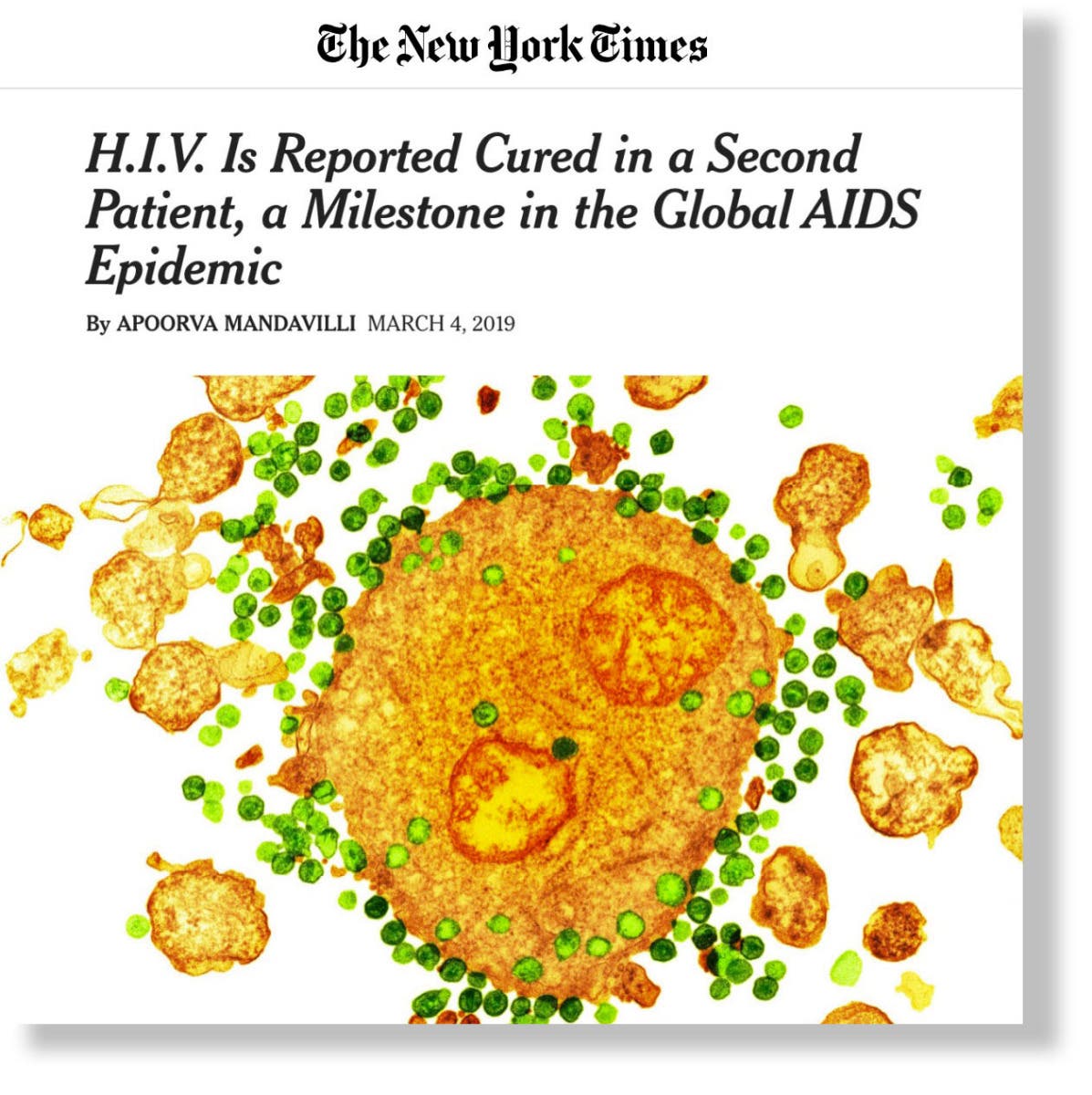 H.I.V. Is Reported Cured in a Second Patient, a Milestone in the Global AIDS Epidemic - NY Times